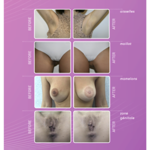 Pink Intimate PROMOITALIA 14x3ml | Peeling Vaginal – Image 3